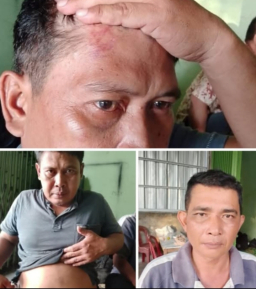 Terduga Oknum Polisi Memukul Tiga Wartawan, Saat Meliput Aksi Demo PT Dinamika Selaras Jaya