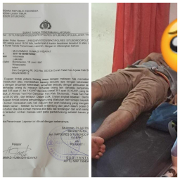 Insiden: Radar Situbondo Dilaporkan Menjadi Korban Dugaan Kekerasan Saat Meliput