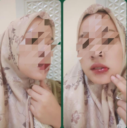 Istri Siri Pingsan Dianiaya Suami di Kafe Bangkalan, Diduga Seorang Wartawan Aktif Bangkalan Yang Lakukan Perselingkuhan