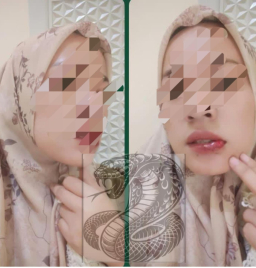 Seorang Wanita Menjadi Korban Aniaya: "Ulah Suami Angin Anginan Angkat Bicara".