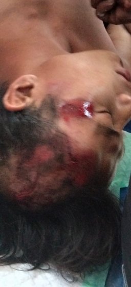 Kecelakaan Tunggal di Desa Harjomulyo Jember, Warga Dusun Guluguh Dilarikan ke Puskesmas
